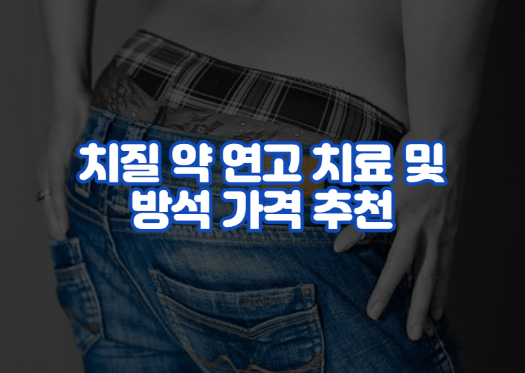 치질 약 연고 치료 및 방석 가격 추천