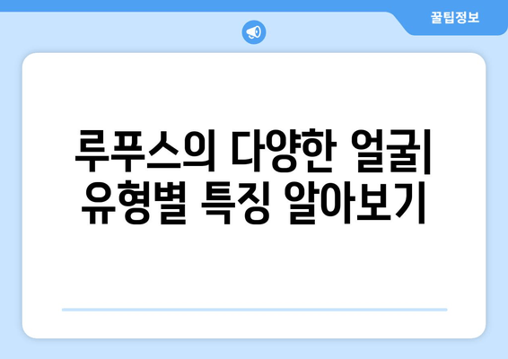 루푸스 진단| 유형, 검사, 조기 발견 | 루푸스 증상, 원인, 치료, 예방