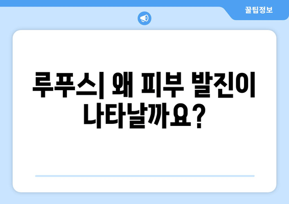 루푸스 피부 발진 완벽 가이드| 유형, 원인, 치료 및 관리 | 루푸스, 피부 질환, 자가면역 질환, 증상