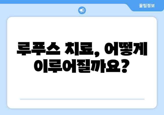 루푸스 비 증상과 치료법 완벽 가이드 | 루푸스, 자가면역질환, 치료, 증상, 진단, 관리