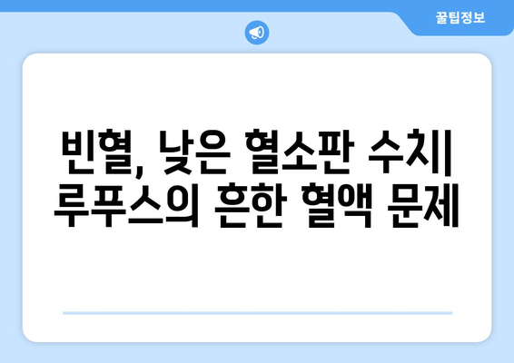 루푸스 혈액 이상| 빈혈, 낮은 혈소판 및 기타 문제 | 원인, 증상, 치료 및 관리 가이드