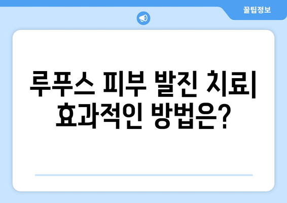 루푸스 피부 발진 완벽 가이드| 유형, 원인, 치료 및 관리 | 루푸스, 피부 질환, 자가면역 질환, 증상