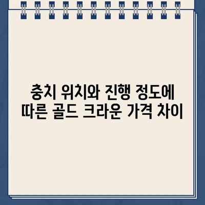 골드 크라운 치료 가격 비교| 충치 위치별, 진행 정도별 비용 알아보기 | 치과 치료 비용, 골드 크라운 가격, 충치 치료