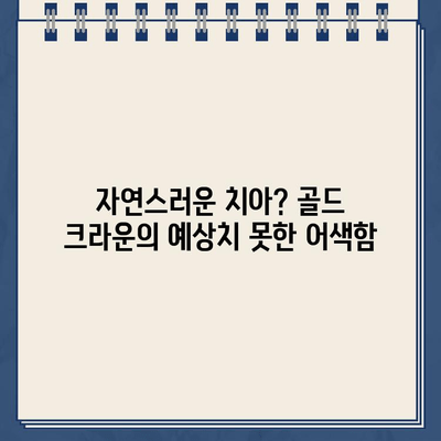 임플란트 골드 크라운의 예상치 못한 미적 단점 | 치아미백, 심미성, 자연스러운 연출