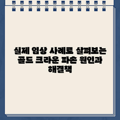 골드 크라운 깨짐, 어떻게 해야 할까요? 실제 임상 사례 분석 | 치과, 크라운, 파손, 치료, 솔루션