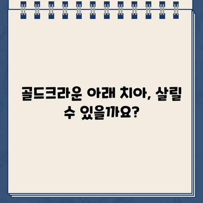 어금니 골드크라운 치통, 임플란트 수술이 필요할까요? | 어금니 통증, 골드크라운, 임플란트, 치과 상담