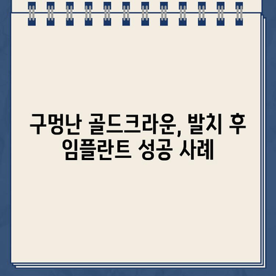 구멍난 골드크라운, 발치 후 임플란트로 새 웃음 찾기| 성공 사례 공유 | 임플란트, 골드크라운, 치아 상실, 치과