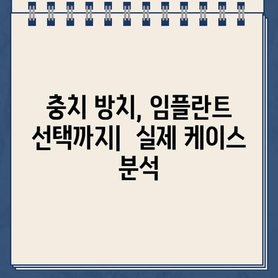 충치 치료 골든타임 놓친 후 임플란트 수술 케이스| 성공적인 치료 과정과 주의 사항 | 임플란트, 치과 치료, 골든타임, 케이스 분석