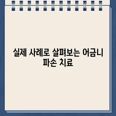 어금니 파손, 골드 크라운 치료가 답일까요? 실제 사례와 함께 알아보세요 | 어금니, 파손, 골드 크라운, 치료, 사례, 비용