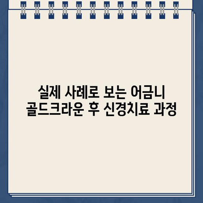 어금니 골드크라운 시술 후 신경치료, 실제 사례로 알아보는 과정 | 어금니, 골드크라운, 신경치료, 치과