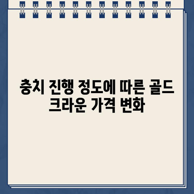 충치 진행 정도에 따른 골드 크라운 가격 비교 가이드 | 치과, 치료 비용, 크라운 종류