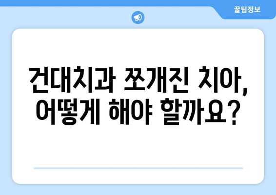 건대치과 쪼개진 치아 치료| 4가지 옵션 비교분석 | 치아 파절, 치아 균열, 치료 방법, 비용