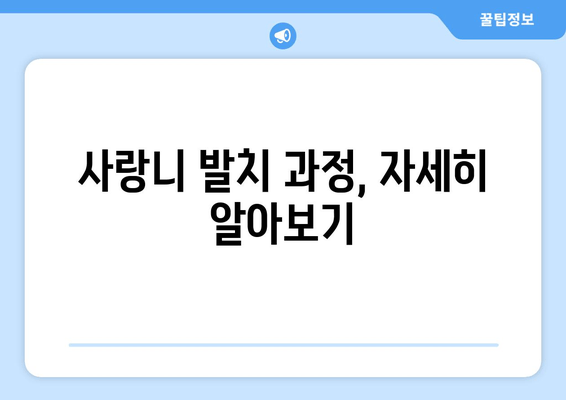 건대치과 누워있는 사랑니, 어떻게 치료해야 할까요? | 사랑니 발치, 난이도, 치료 과정