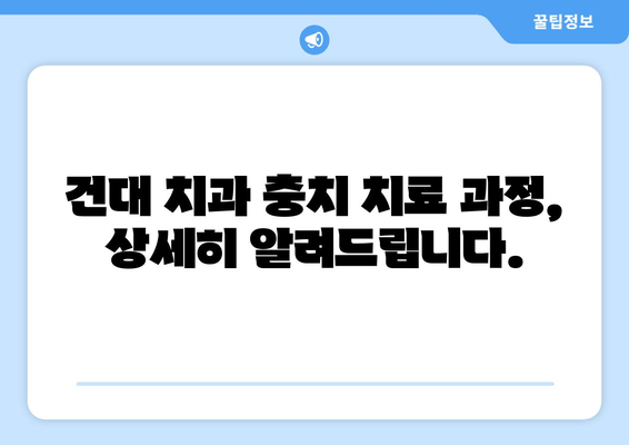 건대치과 충치치료 완료 후기| 솔직한 경험과 치료 과정 공유 | 건대 치과, 충치 치료, 치료 후기, 비용, 추천